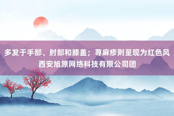 多发于手部、肘部和膝盖；荨麻疹则呈现为红色风西安旭原网络科技有限公司团